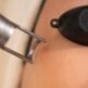 Quels sont les risques et effets secondaires possibles après un traitement au laser ?