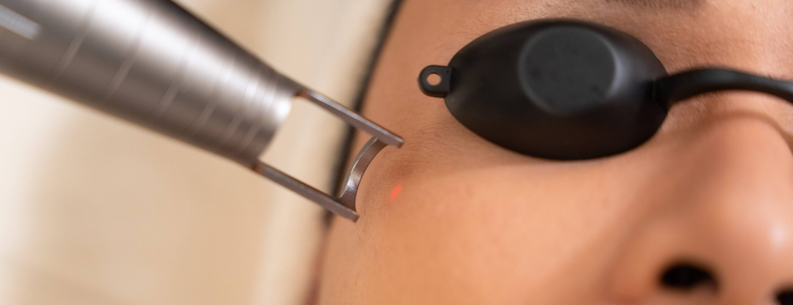 Effets secondaires possibles après un traitement au laser