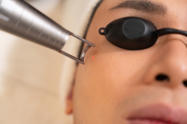 Effets secondaires possibles après un traitement au laser