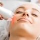 Laser Erbium : pour quels types de rides et imperfections ?